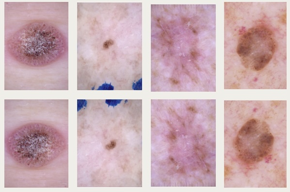 Development of a Mobile Application for Skin Condition Diagnosis and Management