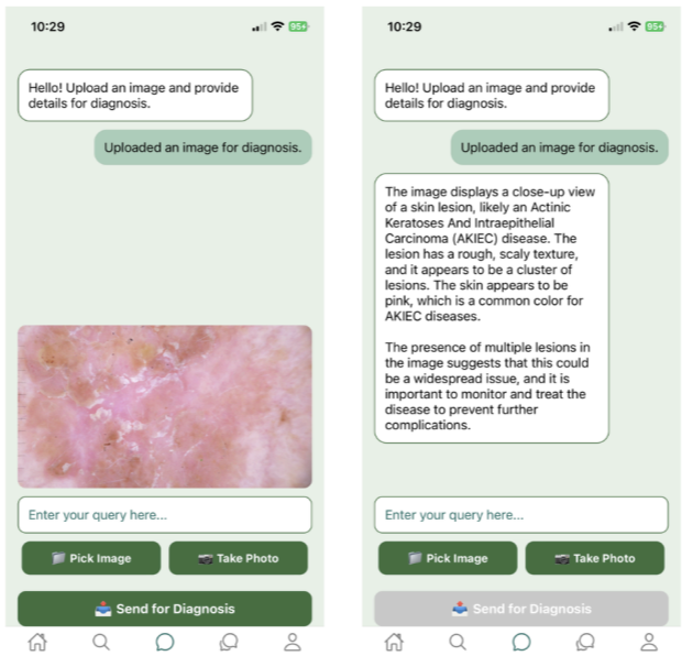 Development of a Mobile Application for Skin Condition Diagnosis and Management