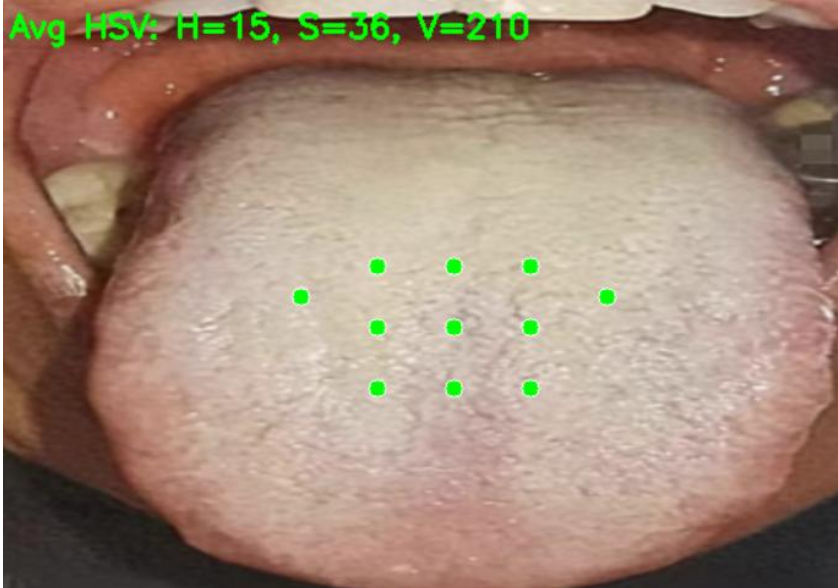 Regimen at Your Finger: An Application Based on Traditional Chinese Medicine